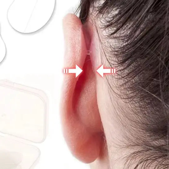 Ear Corrector For Protruding Ears